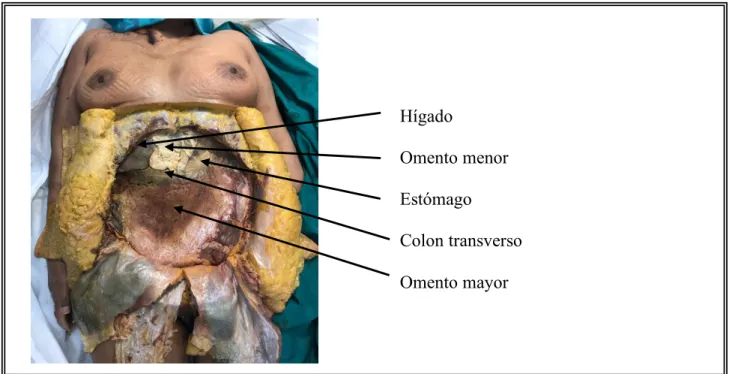 Figura 3: Cavidad peritoneal. 