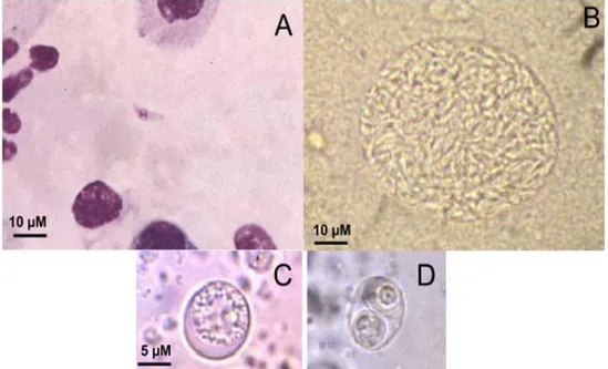 Figura  3.  Formas  de  T.  gondii.  A)  Taquizoítos  en  una  muestra  de  fluido  de  lavado  broncoalveolar teñido con Giemsa (aumento, X500); B) Quiste en el cerebro de un ratón  infectado  lleno  de  bradizoítos  (aumento,  X500);  C)  Ooquiste  sin  