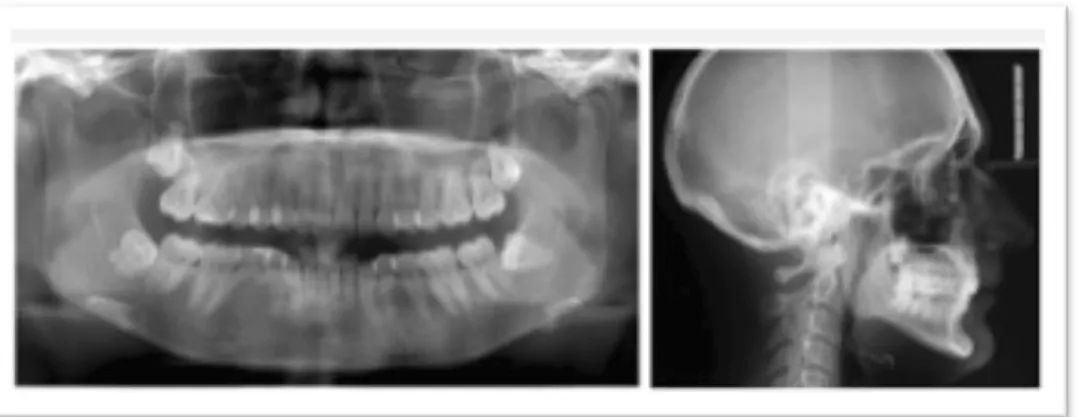 Figura 2.2.- Imagen médica Dicom bidimensional  normalmente usada por dentistas [2] 