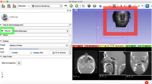 Figura 3.7.- Visualización 3D