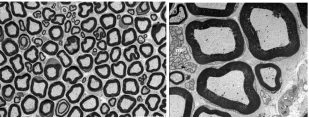 Figura 3: Morfología de las secciones transversales del nervio ciático normal en  microscopía de luz teñidas con azul de toluidina (A) y microscopía electrónica  (B) que representan la distribución normal de axones mielinizados pequeños y  grandes  así  co