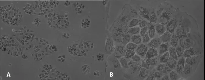 Figura 8: Imagen de EPR en cultivo (día 4) a 20x (A) y 40x  (B). Las células se agrupan  en islotes de mayor tamaño en  comparación con el día 1 (Fig