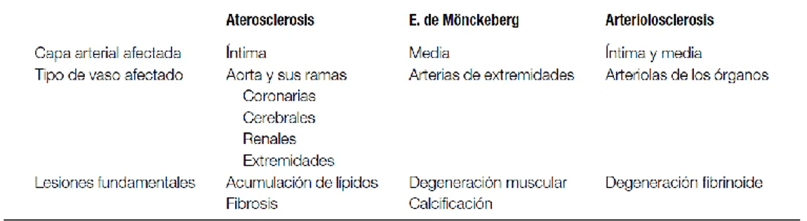 Tabla 2.1: Casos de arteriosclerosis dependiendo de la capa arterial y del vaso afectado  FUENTE: [Pérez Arellano, 2006] 