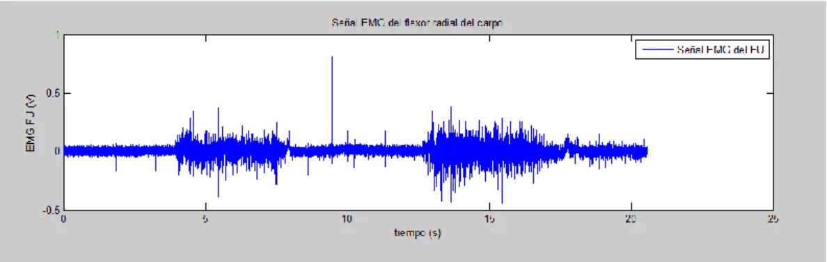 Figura 28.- Electromiográfica del músculo flexor cubital del carpo (FU) al realizar el protocolo 2 