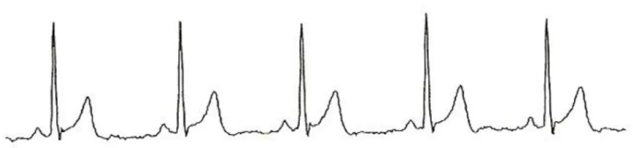 Figura 1.1: Ejemplo de electrocardiograma (ECG).