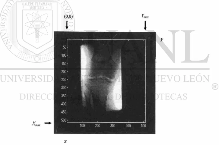 Fig. 2.4. Información visual en una imagen radiográfica. 