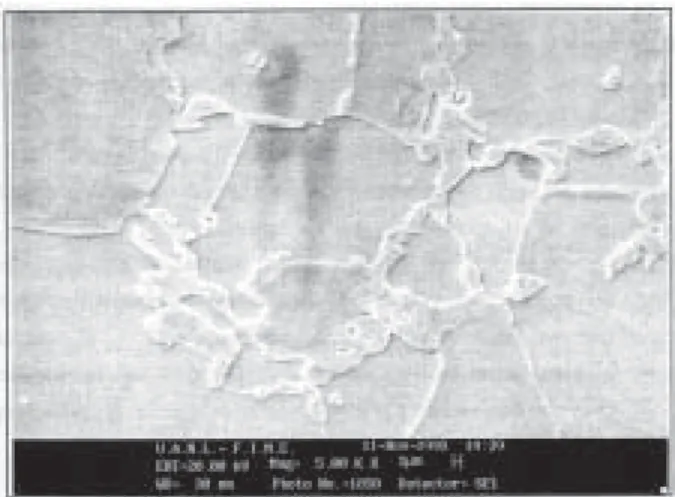 Fig. 2. Imagen de un acero doble-fase.