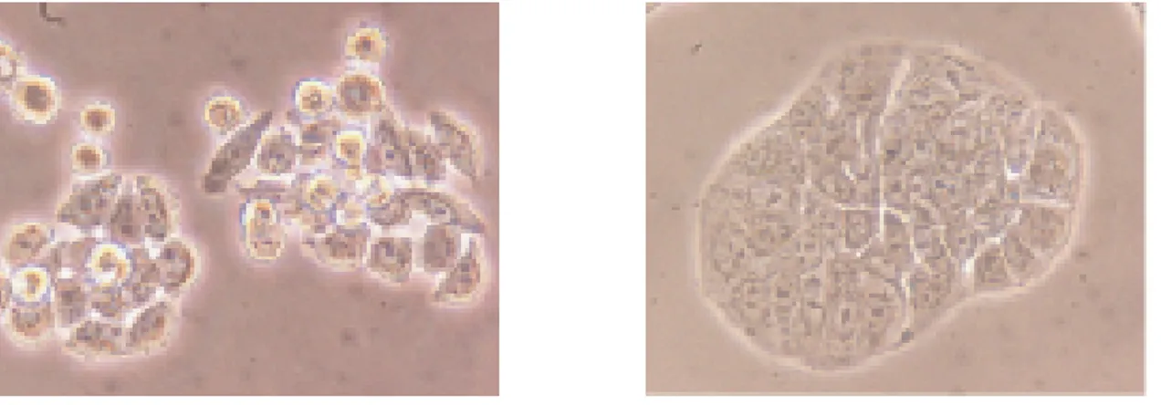 Figura 10. Imágenes de cultivos celulares de las líneas NCM460 (normal) y HT29 (tumoral)