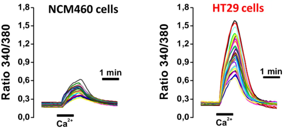Figura  5.  Entrada  capacitativa  de  Ca 2+   en  células  normales  (NCM460)  y  tumorales (HT29)