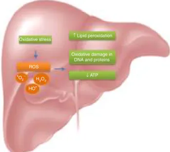 Figure 1 Mechanism of liver damage due to oxidative stress.