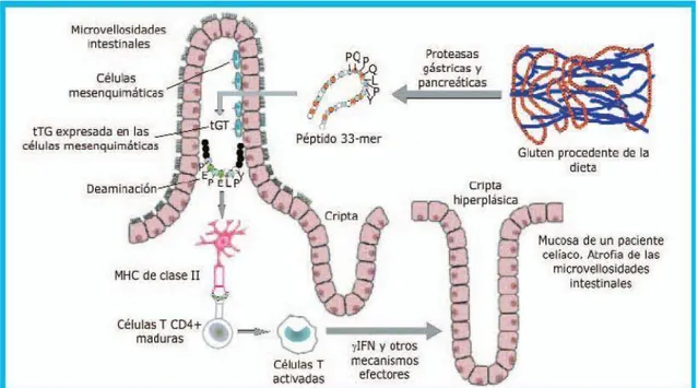 Figura 3. Esquema del mecanismo molecular de la enfermedad celíaca. Tomada en  (35)  