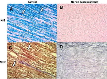 Figura 3. Detección de mielina en el nervio descelularizado. Se utilizó la tinción de K-B y MBP  en el nervio descelularizado con tritón X-100 al 3% y desoxicolato de sodio al 4% por un período  de 15 días