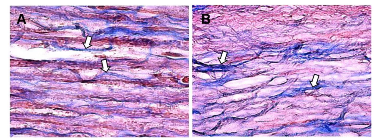 Figura  4.  Detección  de  colágeno  tipo  I  en  el  nervio  descelularizado.  Los  nervios  descelularizados  fueron  teñidos  con  TCM  para  comprobar  si  se  conservaba  la  estructura  de  las  fibras  de  colágeno  después  de  los  15  días  de  t