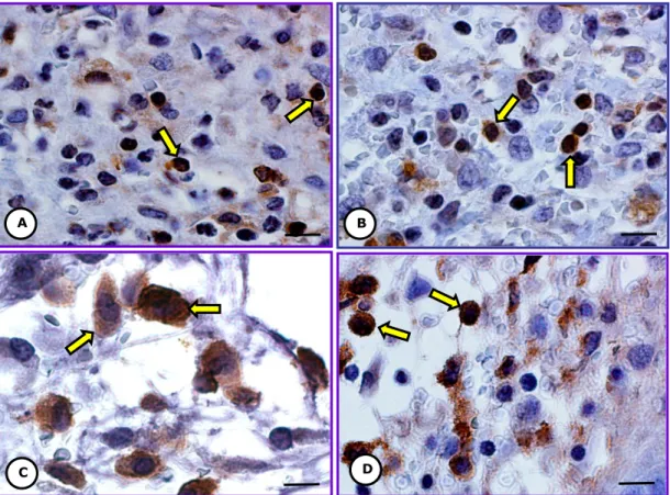 Fig. 3 Células TC-1 en el  sitio de implante. Tratado con PA1. Micrografía de luz.  A) Linfocitos T  (flechas)
