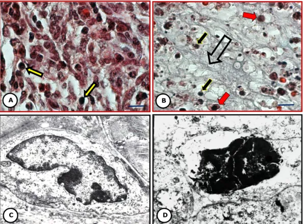 Fig. 5 Células TC-1 en el sitio de implante. Control sin  tratamiento. Micrografía de luz