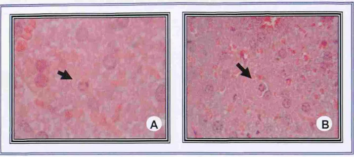 FIGURA 2. Hígado de ratón tratado con PA1. Tiempo de exposición 24 horas. A)  Condensación de la cromatina sobre la envoltura nuclear (flecha)
