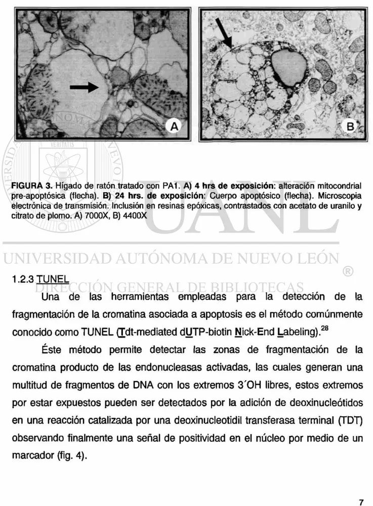 FIGURA 3. Hígado de ratón tratado con PA1. A) 4 hrs de exposición: alteración mitocondrial 