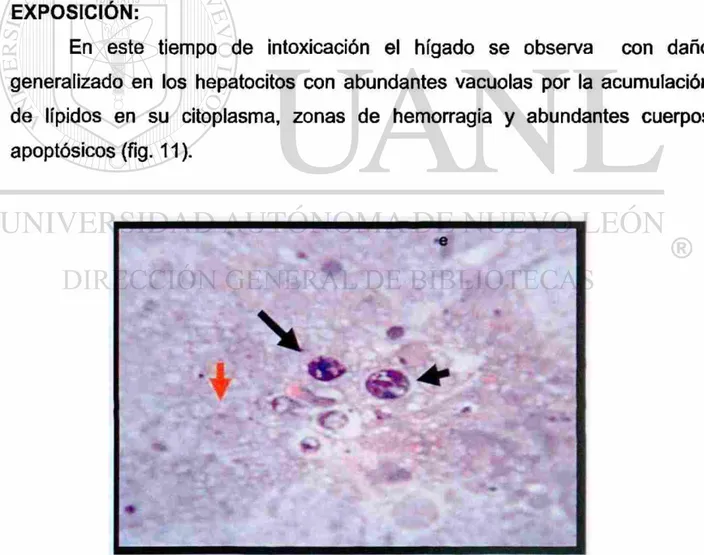FIGURA 11. Hígado de ratón del grupo: Intoxicado con Peroxisomicina A1, 24 horas de 