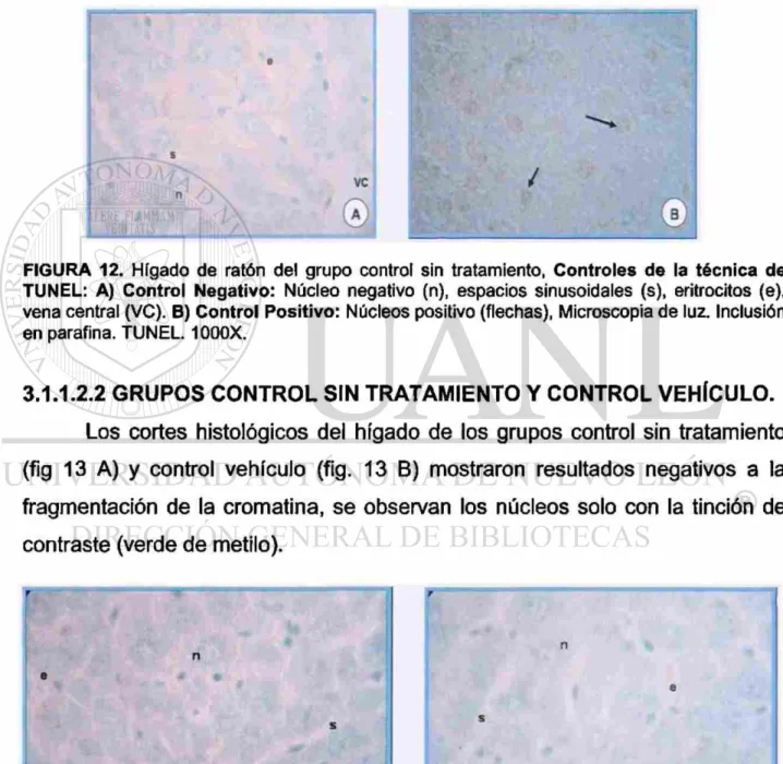 FIGURA 12. Hígado de ratón del grupo control sin tratamiento, Controles de la técnica de  TUNEL: A) Control Negativo: Núcleo negativo (n), espacios sinusoidales (s), eritrocitos (e), 