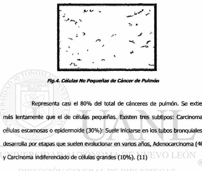 Fig. 4. Células No Pequeñas de Cáncer de Pulmón 