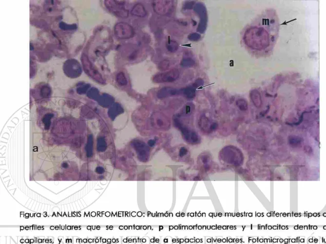 Figura 3. ANALISIS MORFOMETRICO: Pulmón de ratón que muestra los diferentes tipos de  perfiles celulares que se contaron, p poiimorfonucleares y I linfocitos dentro de  capilares, y m macrófagos dentro de a espacios alveolares