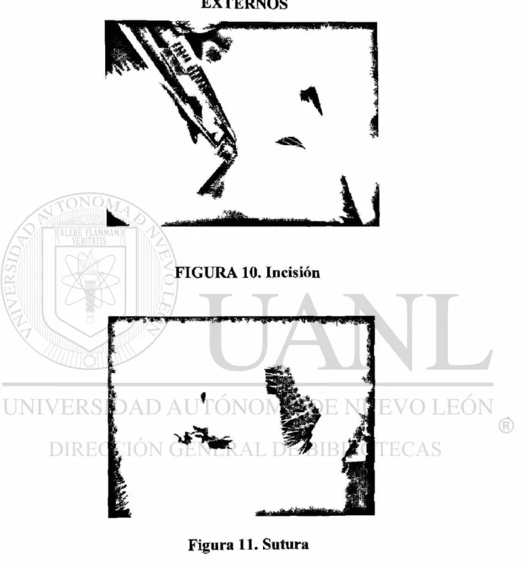 FIGURA 10. Incisión 
