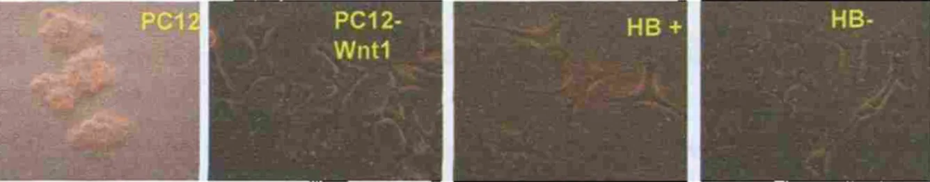 Figura 2. Imagen de las líneas celulares PCI2, PC12 WNT1, HB+ y HB- en cultivo. Las lineas celulares PCI2 /  PC 12 -WNT1 ñieron donadas por el Dr, A.M