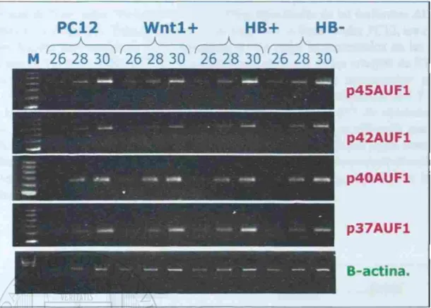 Figura 6. Resultado inicial del análisis de kw niveles de ARNm de ÁUFi por RT-PCR semicuantitativa