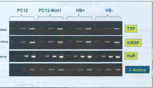 Figura 11. Análisis, por RT-PCR semicuantitativa, de los niveles del ARNm de las proteínas TTP, KSRP y HuR, en  las lineas celulares PC12 (PC 12), PC12-WN H (PCI 2-Wntl), HB+ (HB+&gt; y HB- (1IB-)