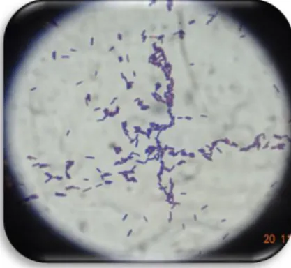 Figura 8 Morfología microscópica de la bacteria clasificada como ESP01 A  donde se observan bacilos cortos Gram positivo