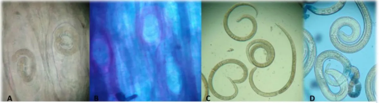 Fig. 9. En A)  compresión en placa de tejido donde se observa  LI de  T. spiralis  con  modificaciones    en  la  estructura  y  en  la  célula  nodriza  B)  tejido  teñido con Azul  tripano  y  observado por  compresión  en placa donde se  observan  LI  d