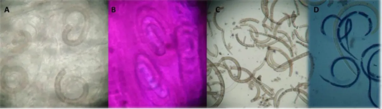 Fig  10.  A)  Compresión en  placa  donde  se  observan  LI  sin  célula  nodriza  y  no  presentan la espirar característica del parasito, B)