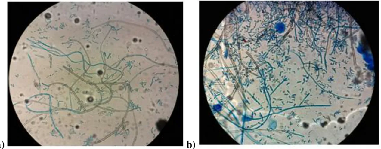 Figura 7. Morfología microscópica del hongo Cladosporium cladosporioides después de 14 días de 