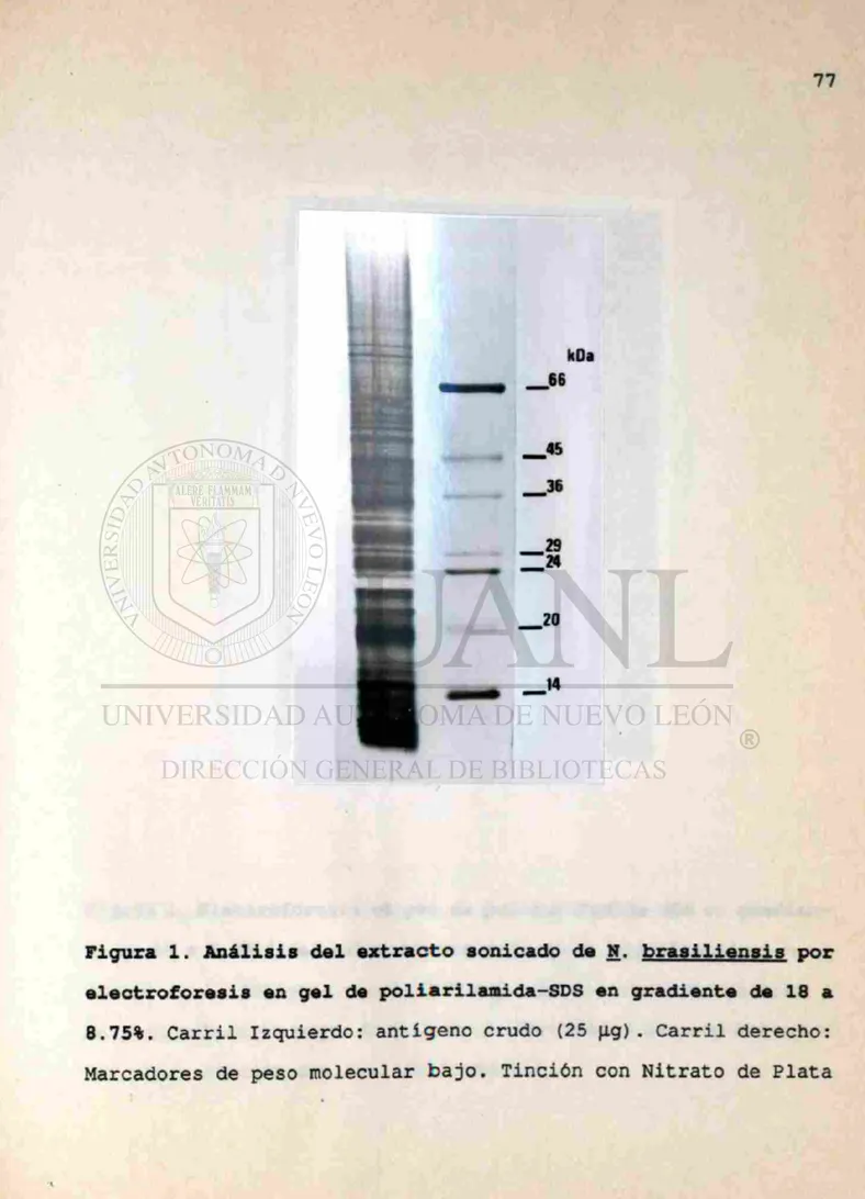 Figura 1. Análisis del extracto sonicado de N. brasiliensis por 