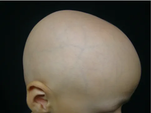 Figura 4.- Alopecia universal 