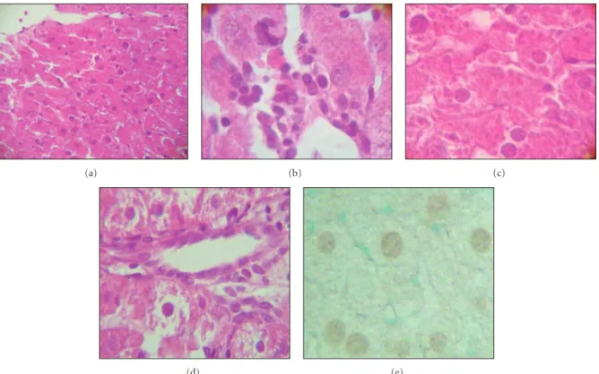Figure 3: Histological lesions in the liver of rats exposed to lead. (a) Structure of a classic lobule with severe damage (H&amp;E stain × 20)