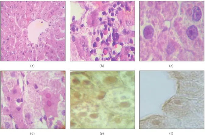 Figure 5: Histological lesions in the liver of rats exposed to lead and treated with glycine 1000 mg/kg for 28 days