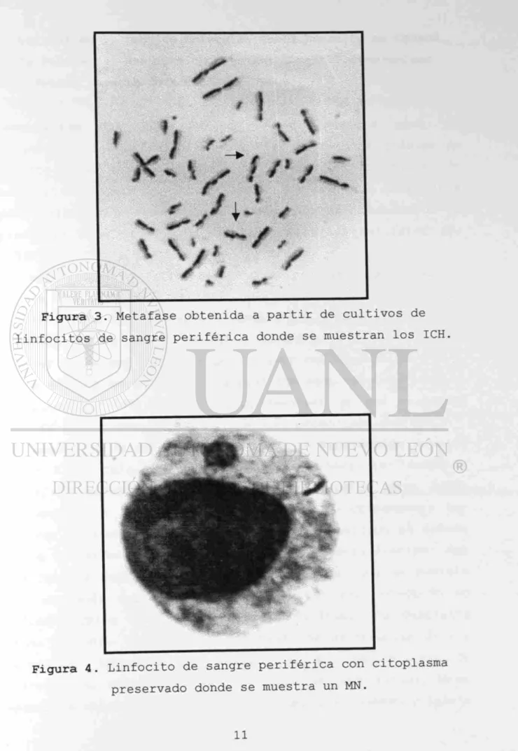 Figura 3. Metafase obtenida a partir de cultivos de  linfocitos de sangre periférica donde se muestran los ICH