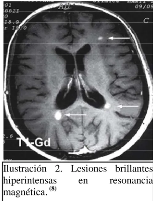 Ilustración  2.  Lesiones  brillantes 