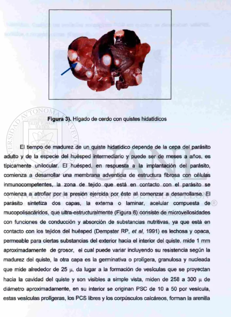 Figura 3). Hígado de cerdo con quistes hidatidicos 