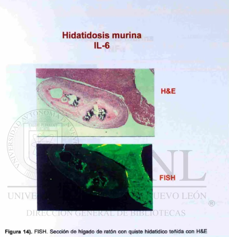 Figura 14). FISH. Sección de hígado de ratón con quiste hidatidico teñida con H&amp;E  mostrando una reacción inflamatoria en el área de implatación