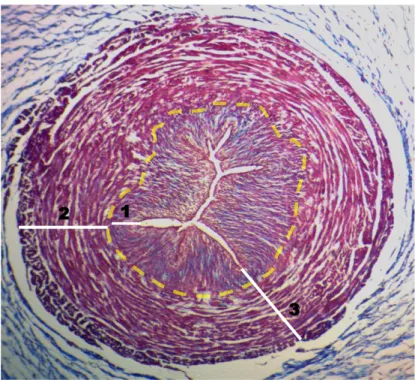 Figura 1. Representación de la morfometría de las túnicas de la pared vascular. 1 es grosor 