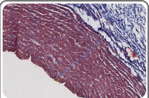 Figura  4.  Vena  umbilical  humana  control.  Microfotografía  de  campo  claro,  corte 