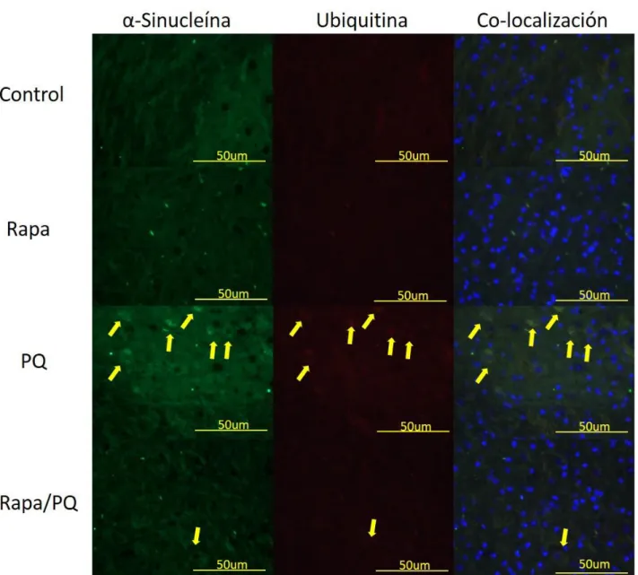 Fig.  9.  La  agregación  de  las  proteínas  α-sinucleína  y  ubiquitina  disminuye  al  estimular  la  autofagia