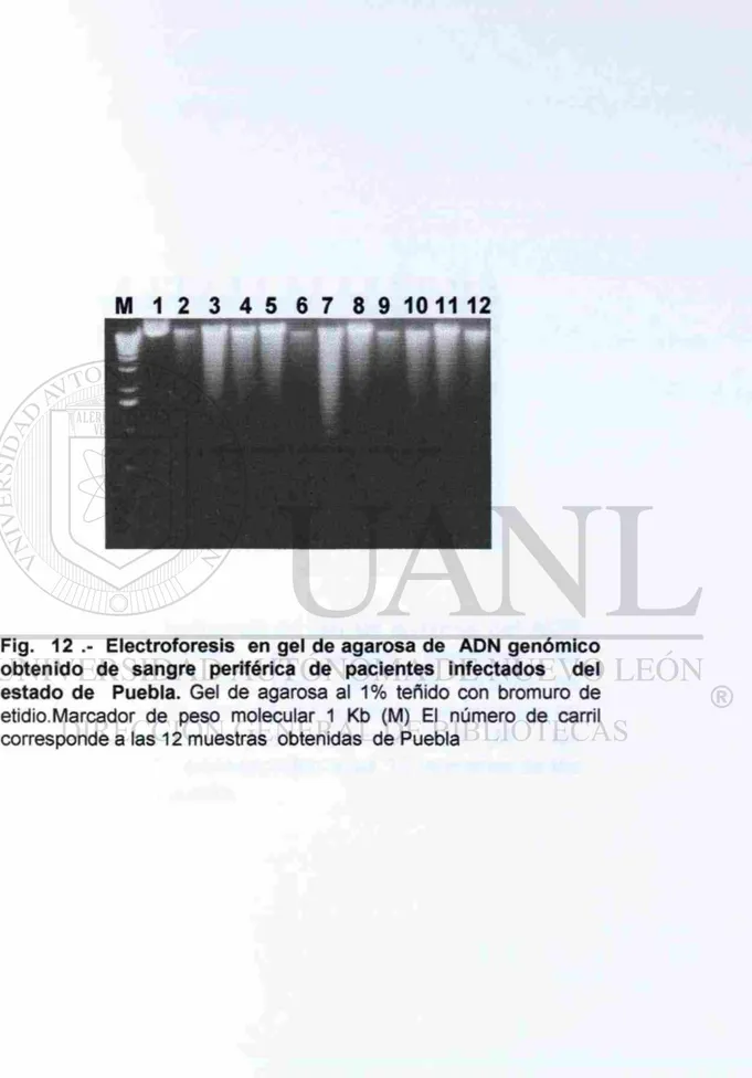 Fig.  1 2 . - Electroforesis en gel de agarosa de ADN genómico  obtenido de sangre periférica de pacientes infectados del  estado de Puebla