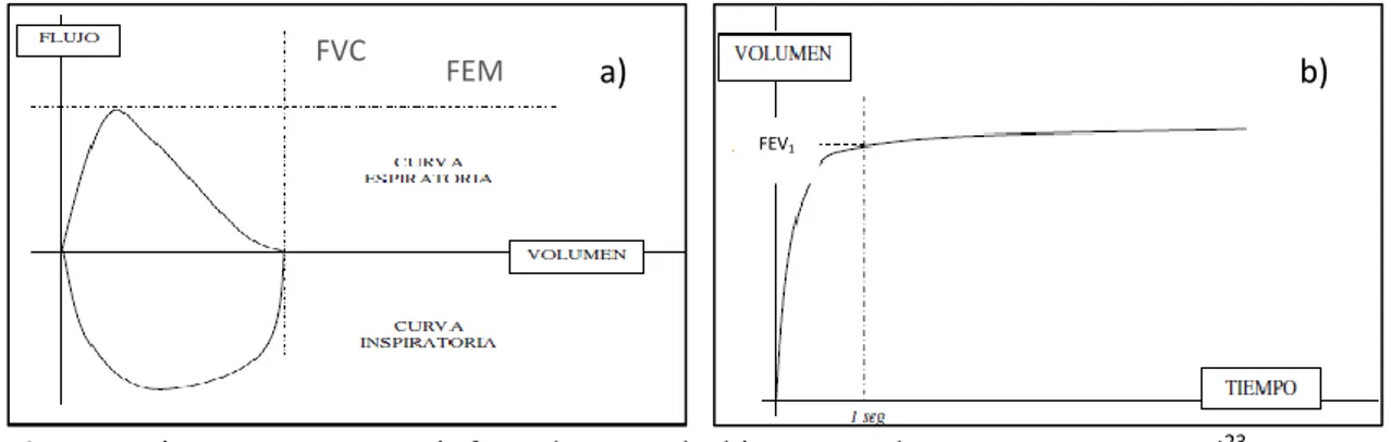 Figura 2. a) Curva espirometría forzada normal    b) Curva  volumen- tiempo normal 23