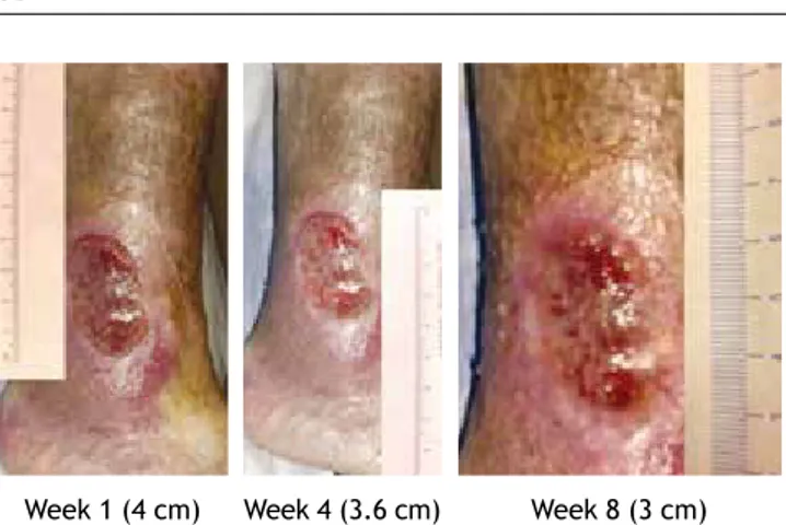 Figure 5  images of the follow-up of a patient from group A  (compressive therapy).