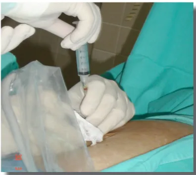 Figura 5. Caso 2.  Defecto abdominal cerrado