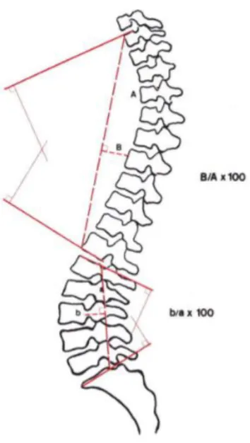 Fig. 6 Método de Voutsinas y Mcewen  