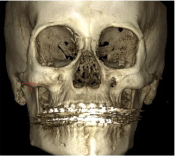Figura 8. CTCB pre operatorio  